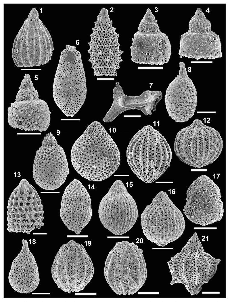 Middle-Late Giurassic radiolarians (Koziakas, Greece) photographed using a scanning electron microscope, scale bar 50 μm